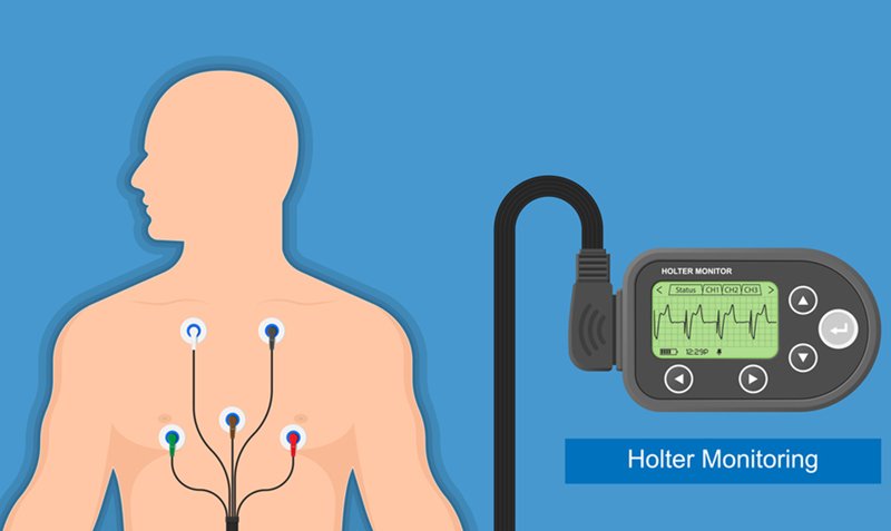 Holter Services at Home