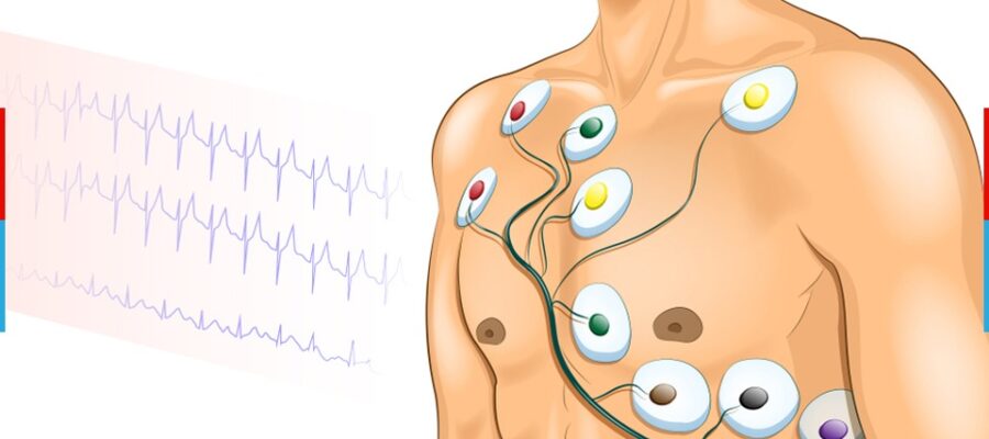 ECG at home