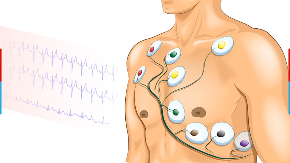 ECG at home