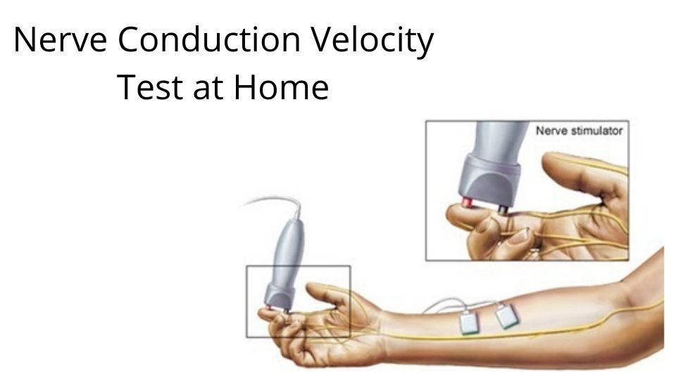 NCV Test at home