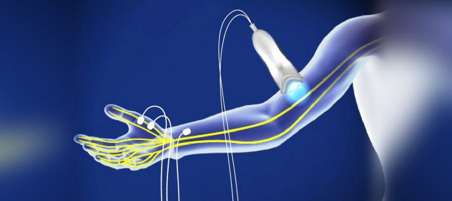 ncv-test-at-home