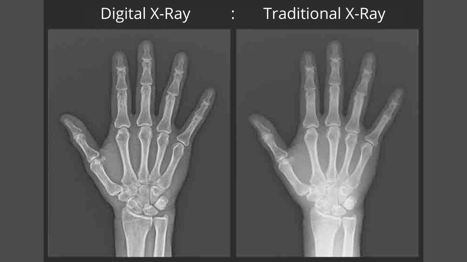 digital-x-ray-at-home