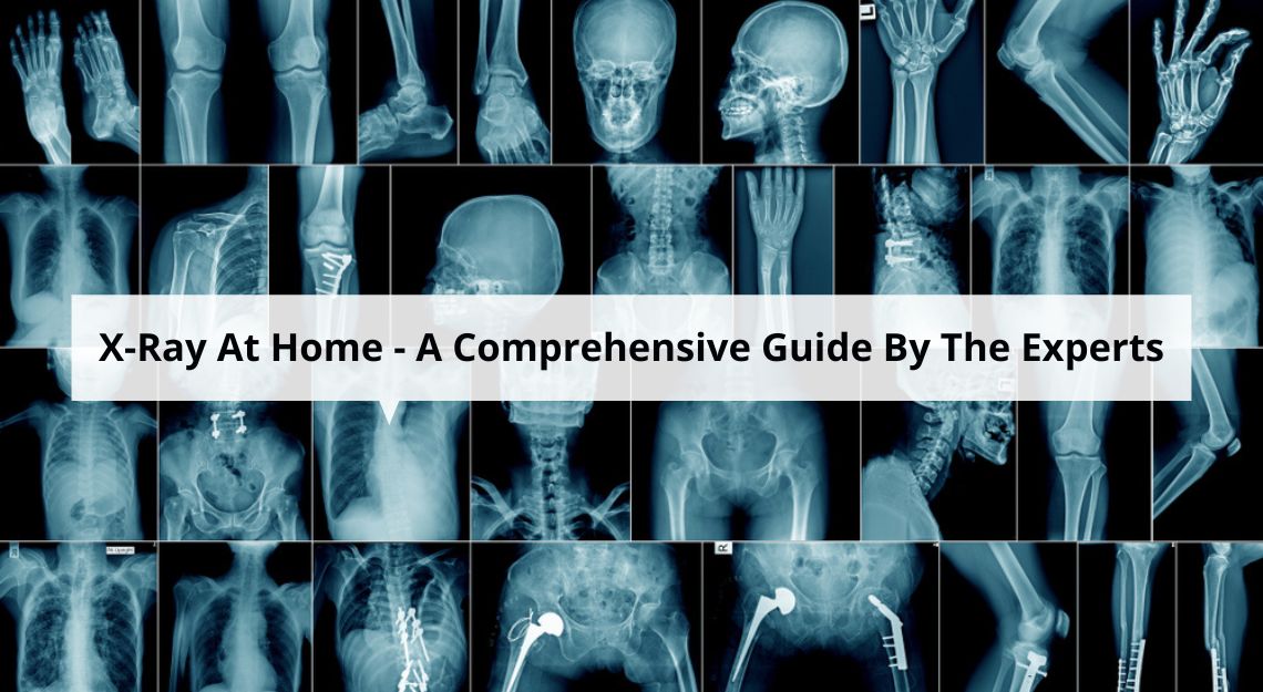 X-Ray-At-Home