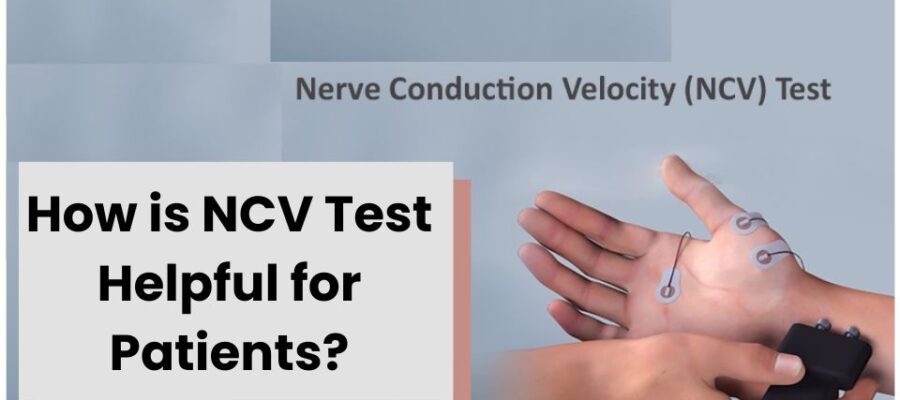 NCV-Test