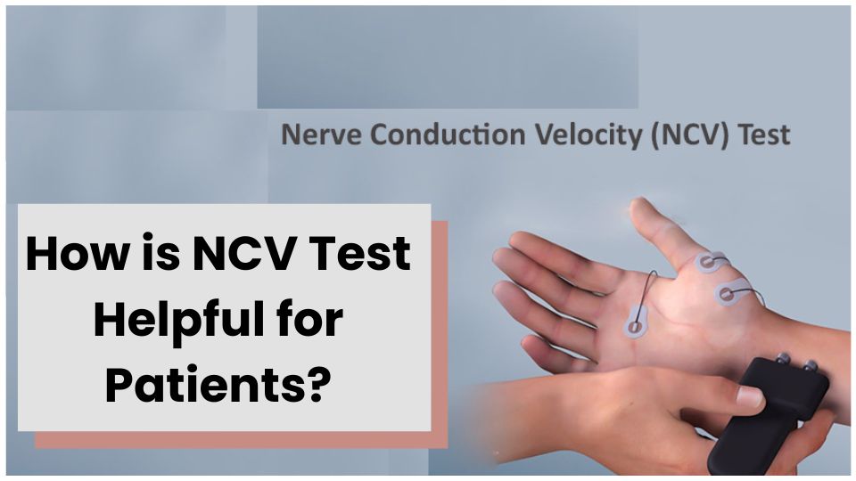 NCV-Test