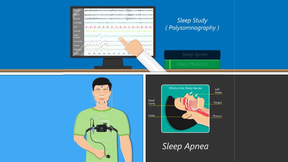 sleep study test at home