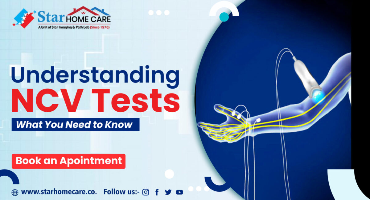 ncv-test